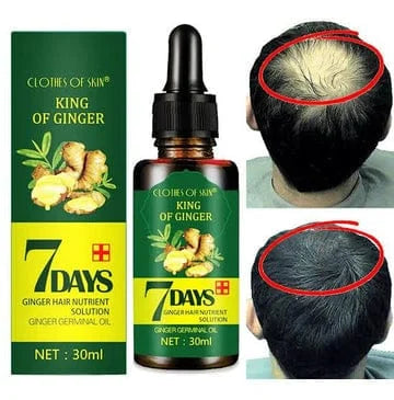 Ginger Germinal Oil, Ginger Hair Growth Serum, Hair Growth Oil, Hair Growth for Women & Men Stronger, Thicker, Longer Hair Thinning Treatment  30 ML